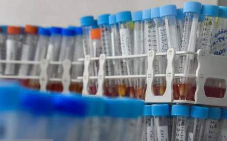 پاسخ وزارت بهداشت به اظهاراتی درباره کمبود لوله‌ نمونه‌گیری در آزمایشگاه‌ها