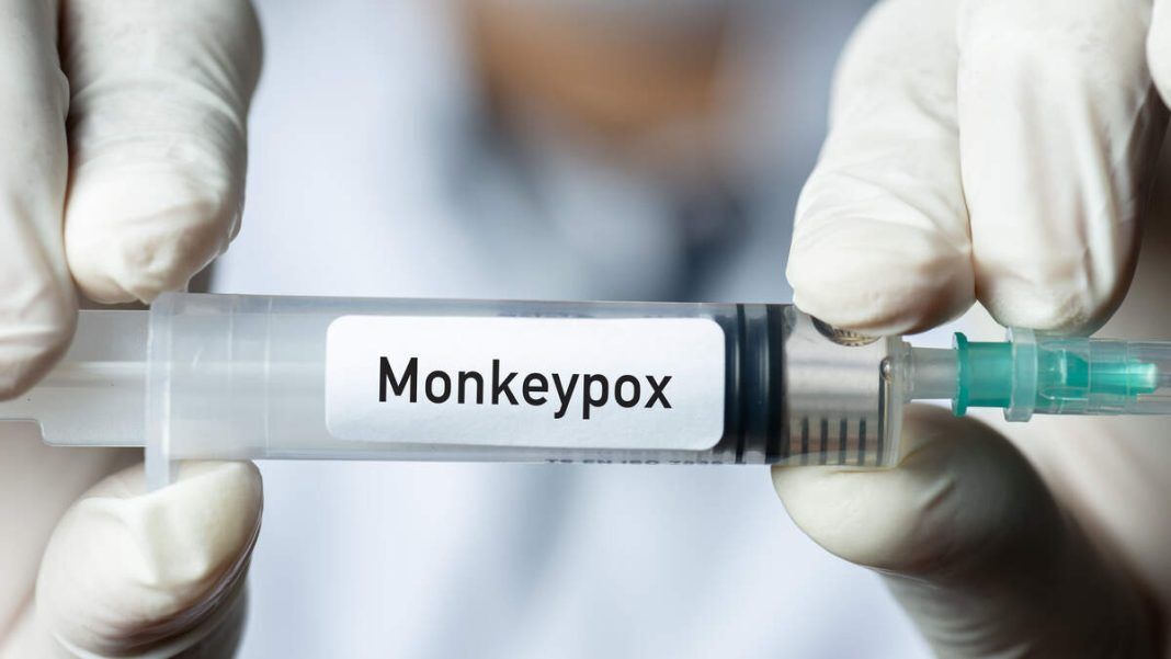 آخرین آمار مبتلایان آبله میمون در جهان
