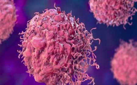 احتمال ورود واکسن HPV به برنامه واکسیناسیون ملی