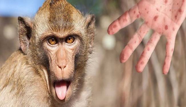 آخرین اطلاعات علمی درباره «آبله میمون»؛ از این ویروس بترسیم یا نترسیم؟