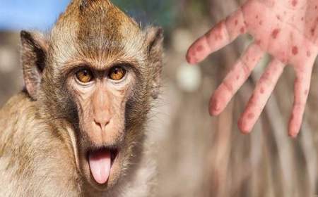 آخرین اطلاعات علمی درباره «آبله میمون»؛ از این ویروس بترسیم یا نترسیم؟
