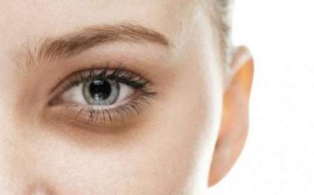 کبودی در این قسمت های بدن خطرناک است بلافاصله به پزشک مراجعه کنید