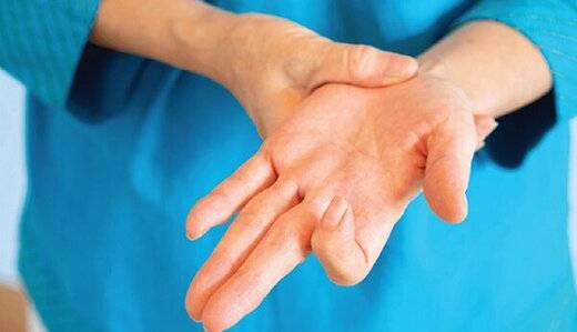 عارضه «انگشت ماشه‌ای» نشانه این بیماری خطرناک است