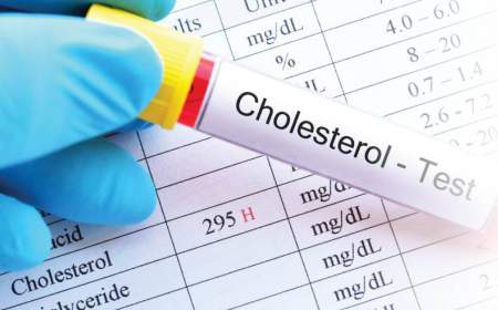 خطر کلسترول بالا با رفتارهای غلط