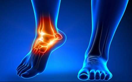 درد‌های مچ پا چه زمانی خطرناک هستند؟