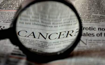 سرطان پروستات دومین سرطان شایع مردان ایرانی