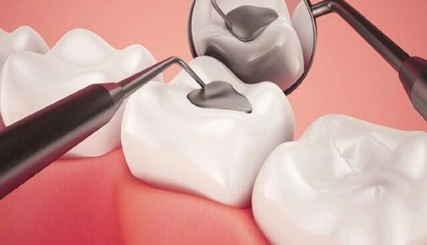مایع ارزان‌قیمتی که دندان‌ها را «ضد پوسیدگی» می‌کند